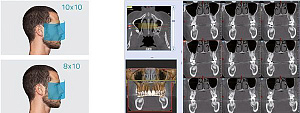 Стоматологический томограф NewTom 2D/3D GO (10x10) с цефалостатом - Фото 8