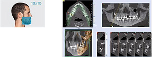 Стоматологический томограф NewTom 2D/3D GO (10x10) - Фото 10
