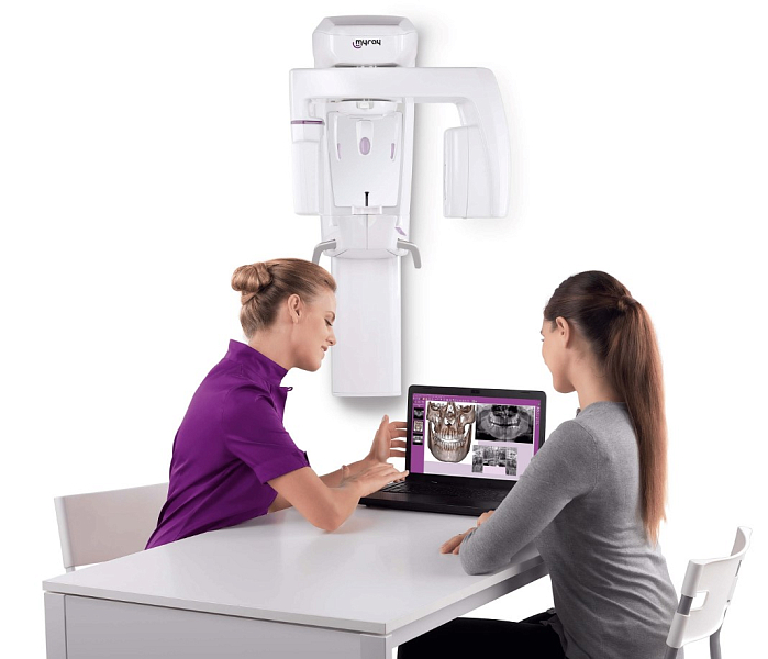 Дентальный томограф Cefla MyRay Hyperion X5-3D, FOV 10x10 - Фото 3